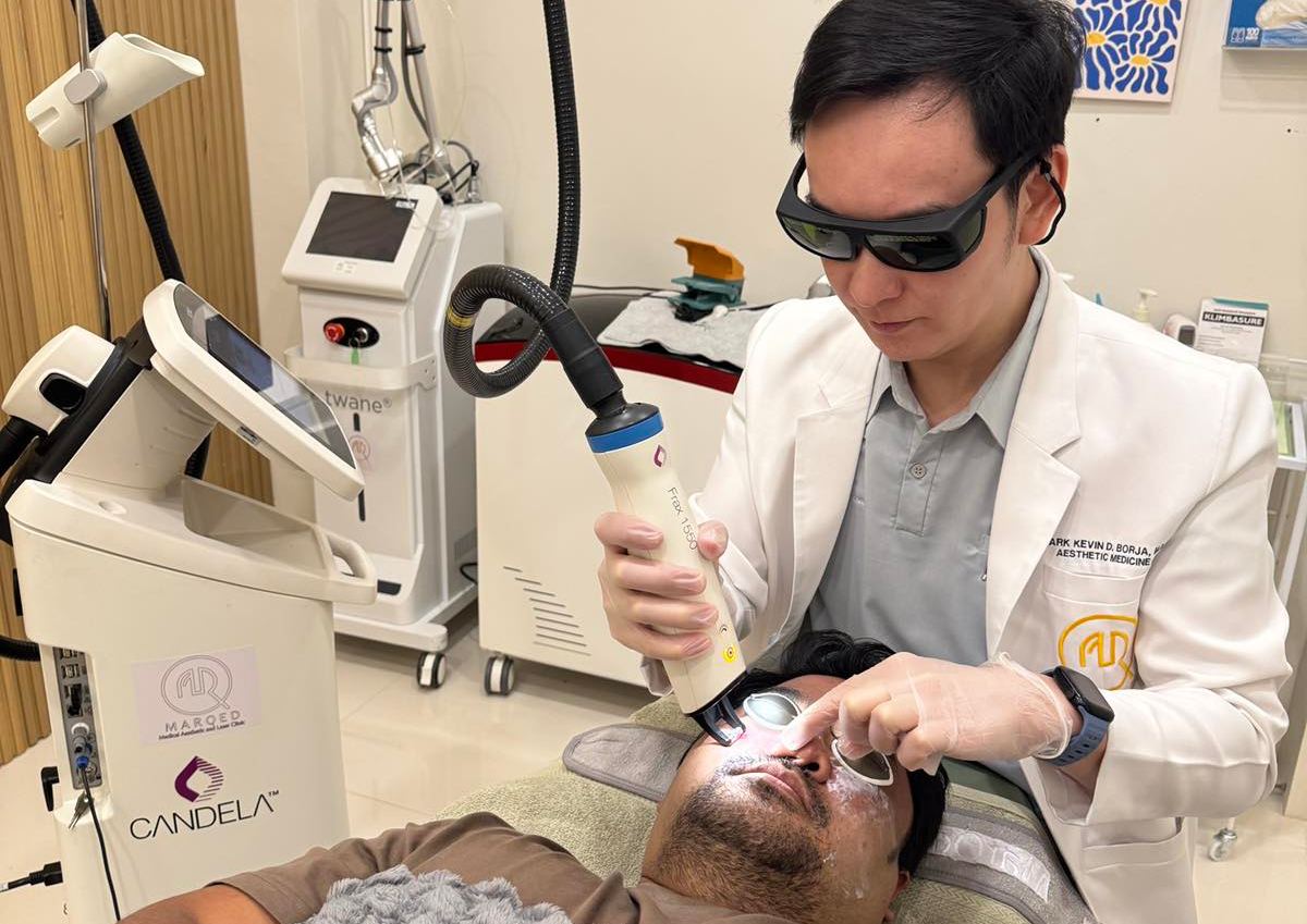 Treat Scars the Smart Way with Frax Pro Laser
