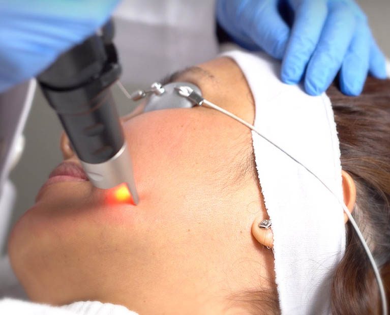 Painless Laser Treatment